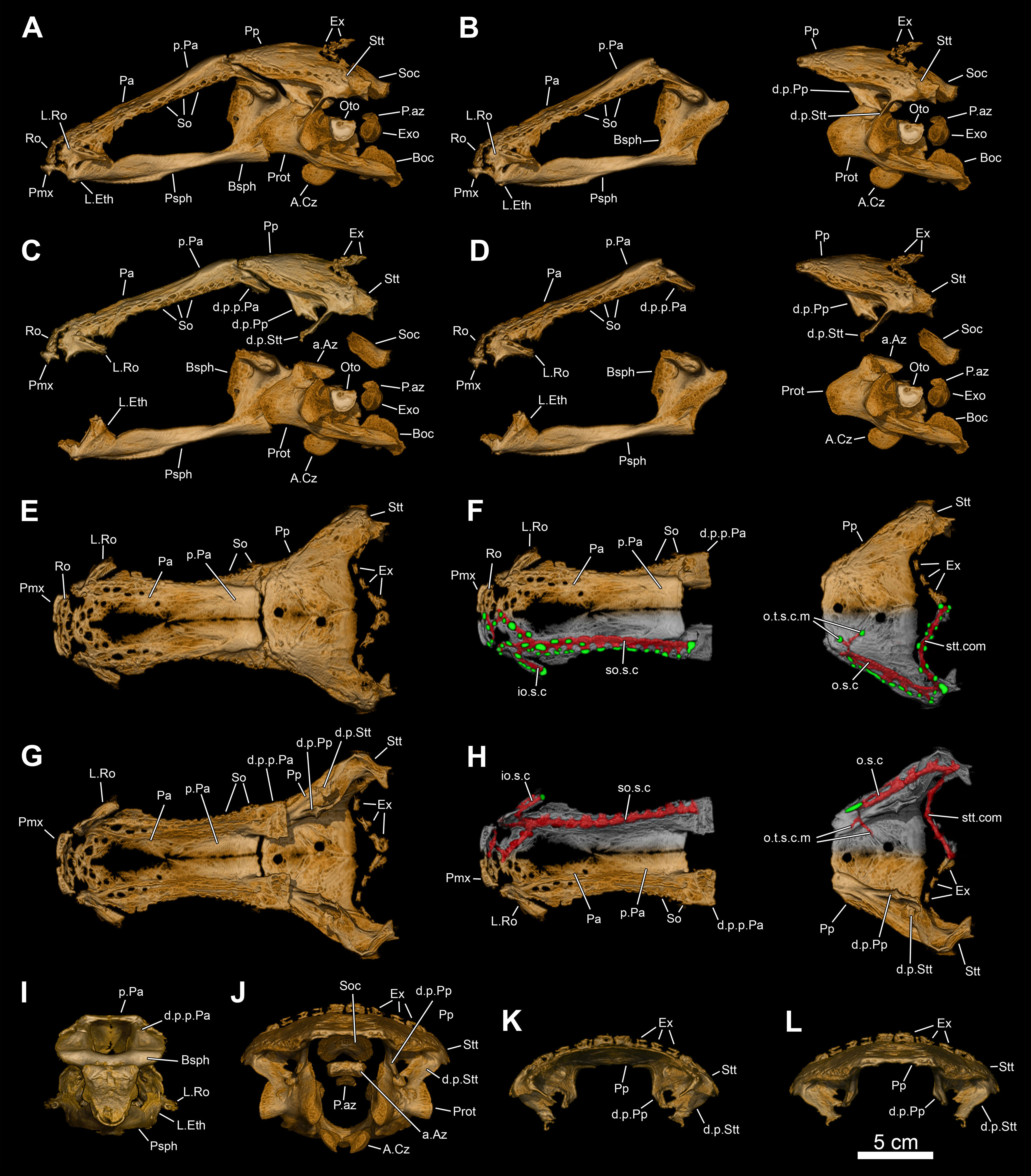 Braincase